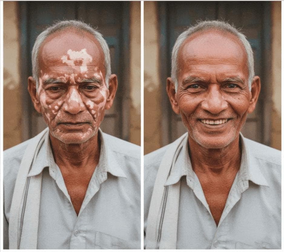 Patient before and after result